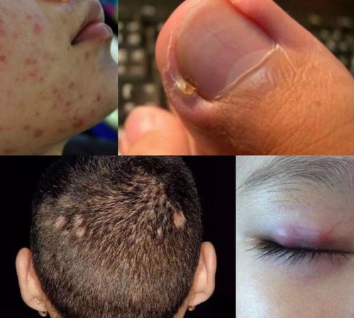 狐臭界的 印度神药 3秒止臭,不用开刀也能彻底根治