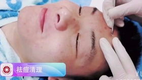 兰州治疗腋臭的医院