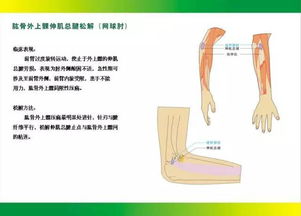 针刀松解治疗最全图解